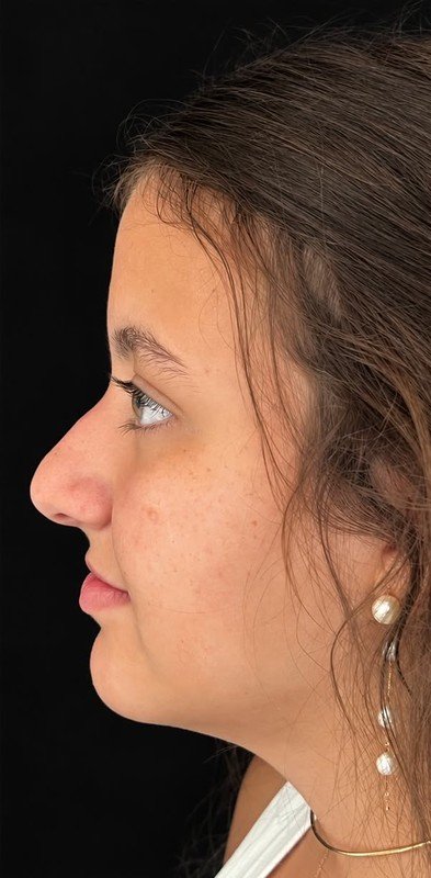 Caso 08, antes da cirurgia