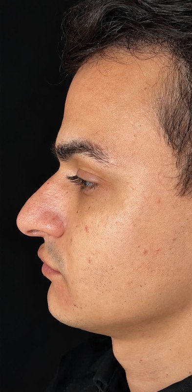 Caso 10, antes da cirurgia